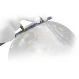 R&Egrave;GLE ARQU&Eacute; STORM